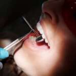 Teeth whitening Treatments for Adults with the best dental healthcare