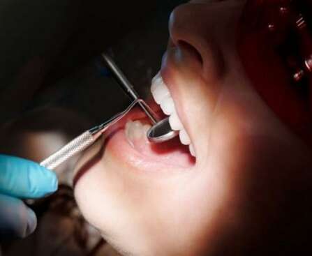 Teeth whitening Treatments for Adults with the best dental healthcare