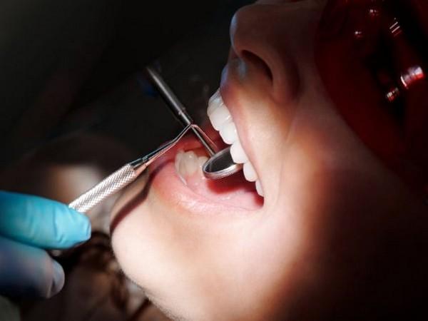 Teeth whitening Treatments for Adults with the best dental healthcare